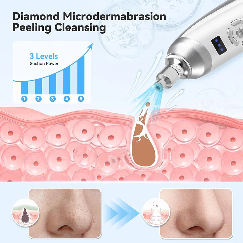 Blackhead Removal Facial Skin Care Beauty Device