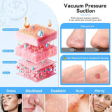 Blackhead Removal Facial Skin Care Beauty Device